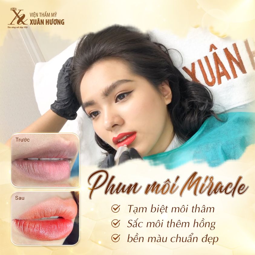 Ưu điểm nổi bật của Phun môi Miracle