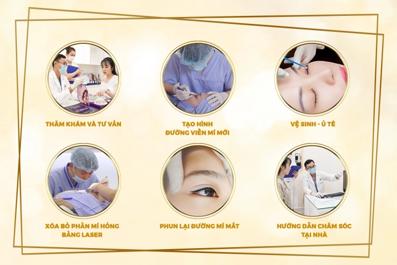 Quy trình chỉnh sửa mí Miracle