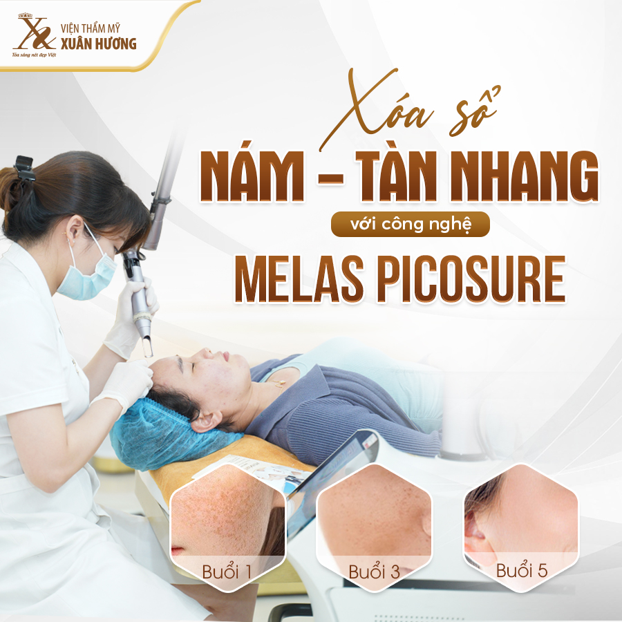 Tìm hiểu về công nghệ Melas Picosure