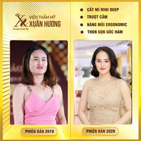 kết quả sau thẩm mỹ tại Xuân Hương