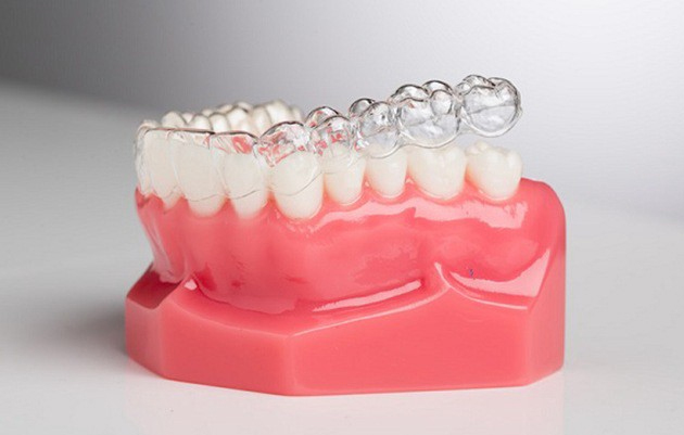 Niềng răng vô hình Invisalign chuẩn y khoa