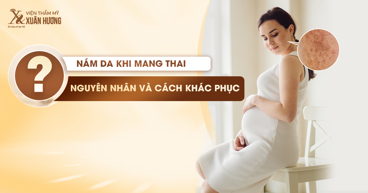 Một số biện pháp giúp giảm nám da khi mang thai hiệu quả