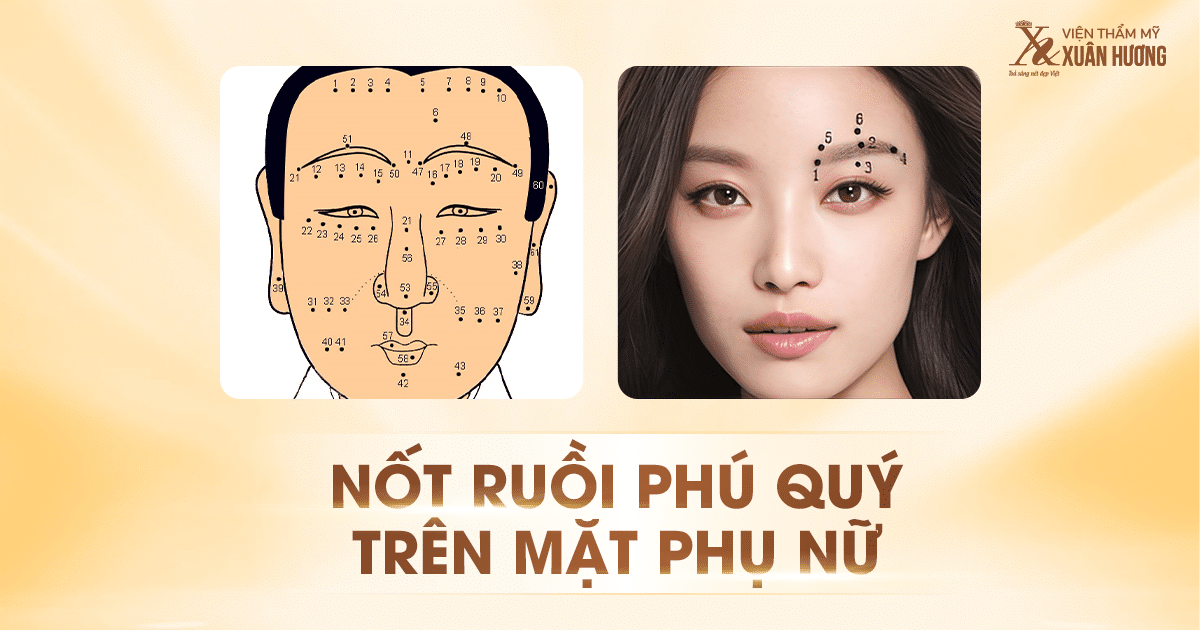 nốt ruồi phú quý trên mặt phụ nữ