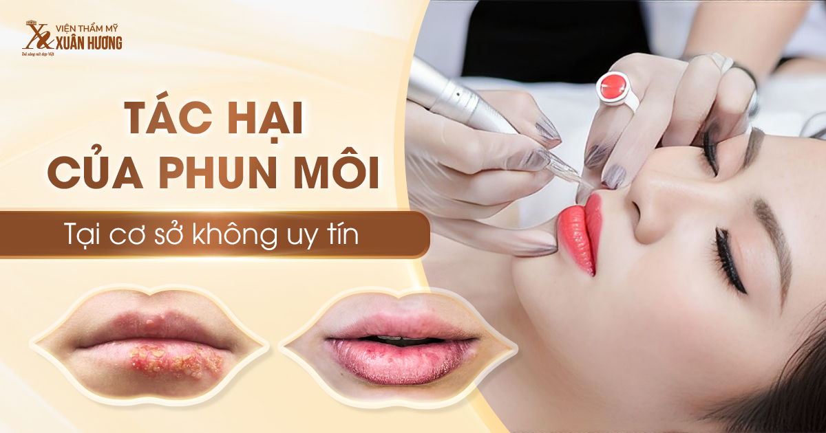 Tác hại của phun môi tại cơ sở thẩm mỹ không uy tín