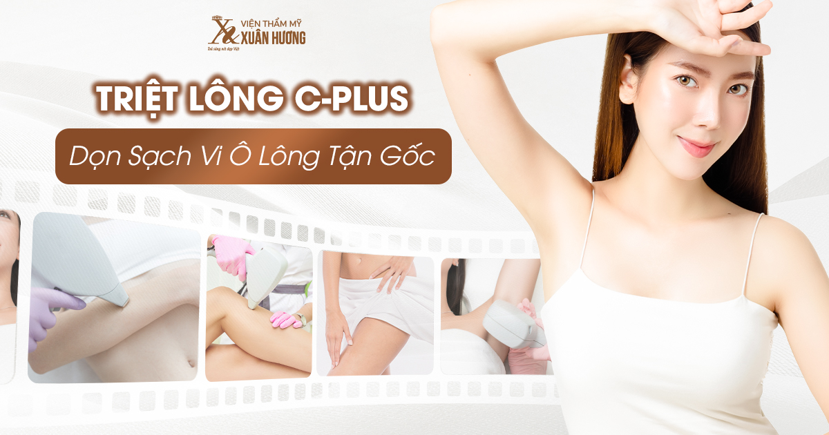 triệt lông C Plus tại Viện Thẩm Mỹ Xuân Hương