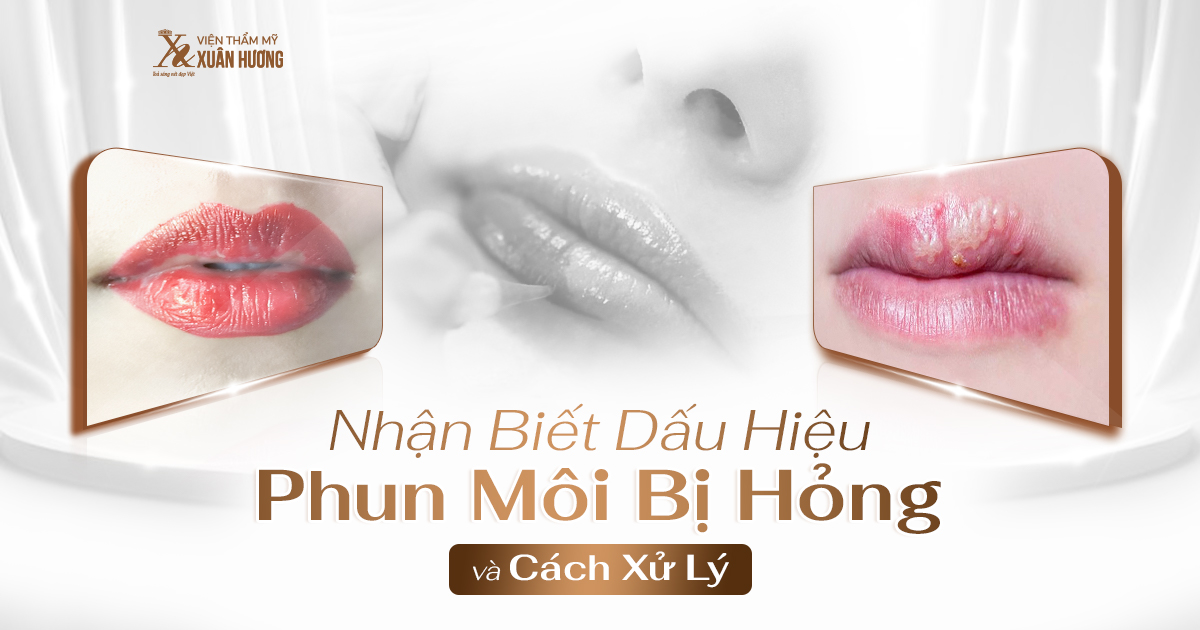 dấu hiệu phun môi bị hỏng