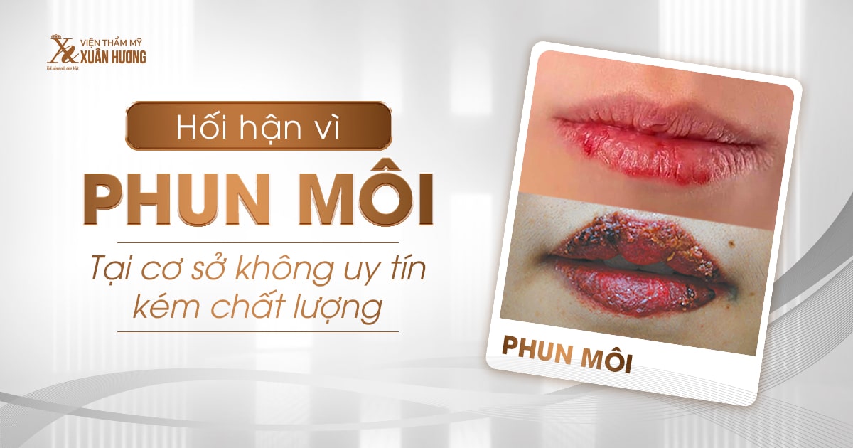 hối hận vì phun môi tại cơ sở kém chất lượng