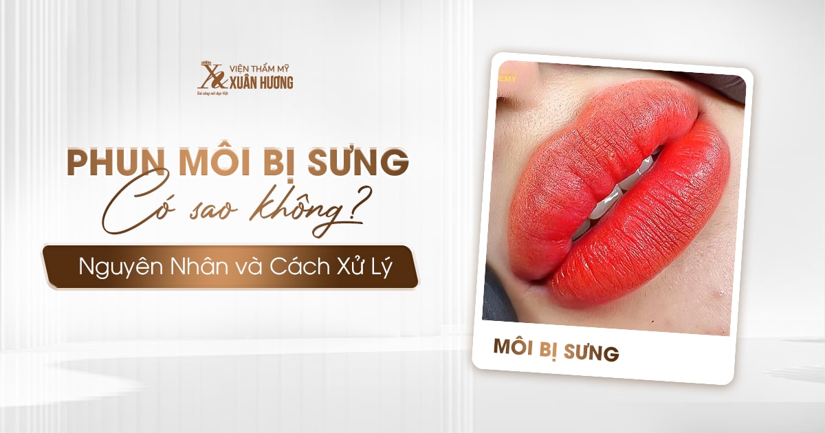 phun môi bị sưng