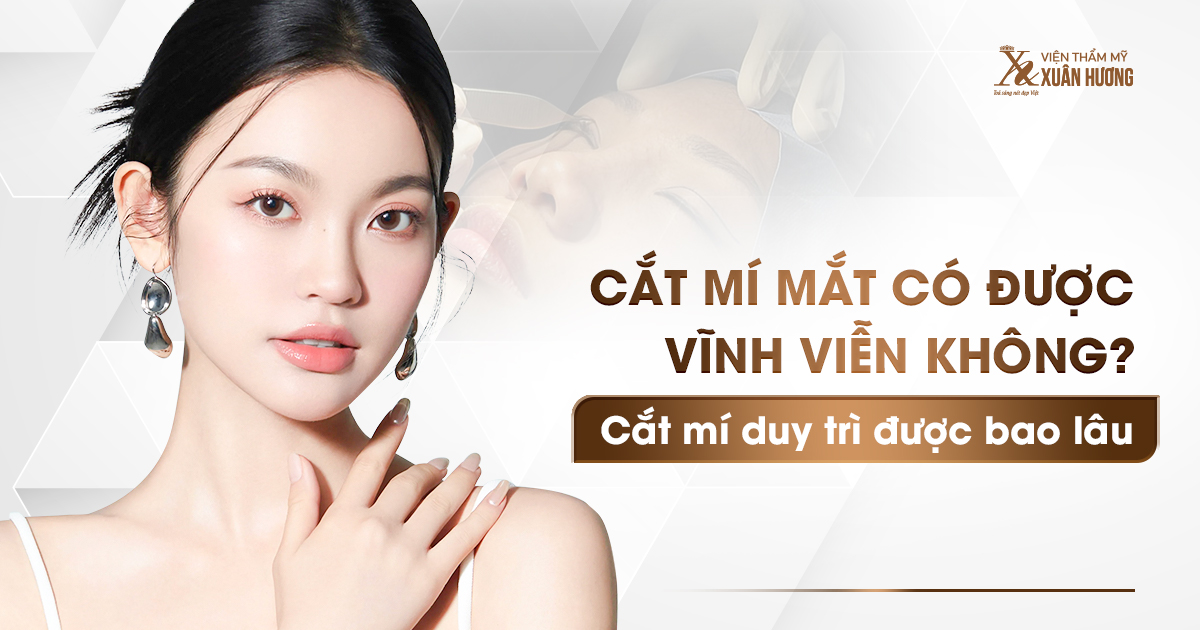 cắt mí có được vĩnh viễn không