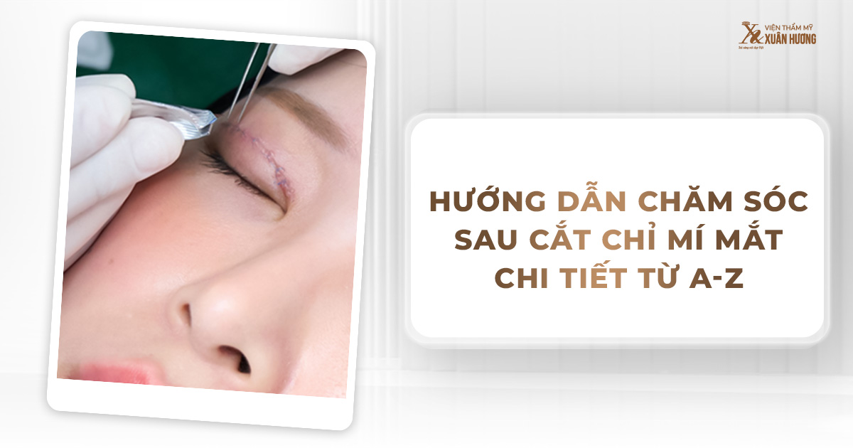 chăm sóc sau cắt chỉ mí mắt