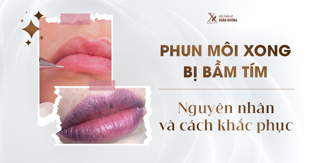 phun môi xong bị bầm tím