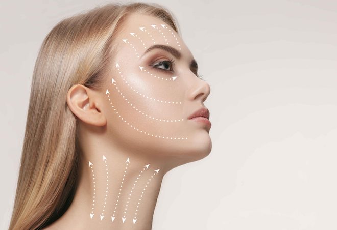 Căng chỉ collagen sinh học