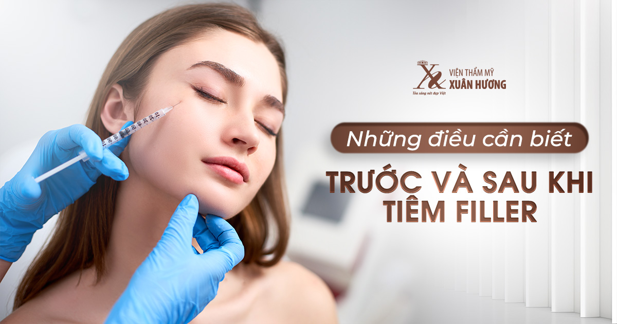 những điều cần biết khi tiêm filler