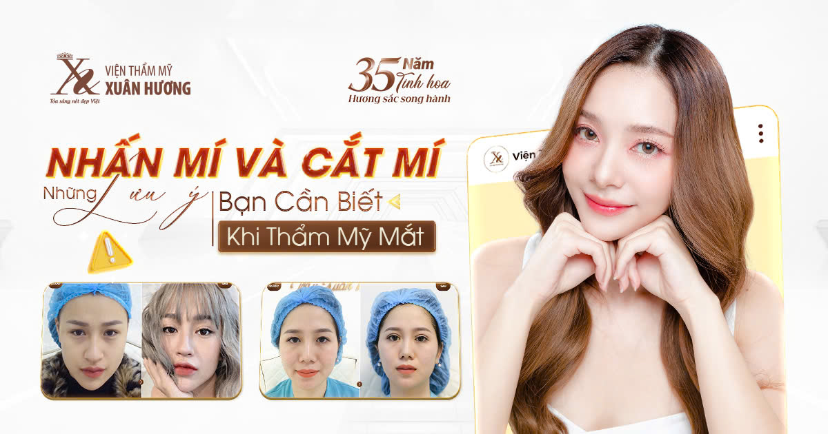 nhấn mí và cắt mí